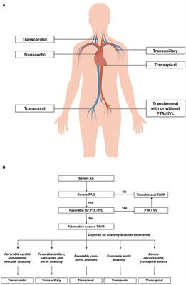 Advances in technology and techniques for transcatheter aortic valve replacement with concomitant peripheral arterial disease